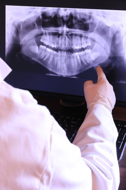 Best Broken or Chipped Tooth Repair in Beechwood Trails, OH